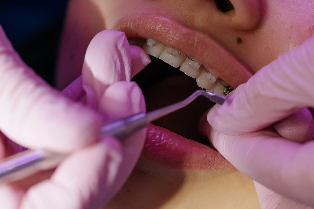 orthodontiste